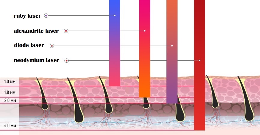 LASER HAIR REMOVAL LASER HAIR REMOVAL